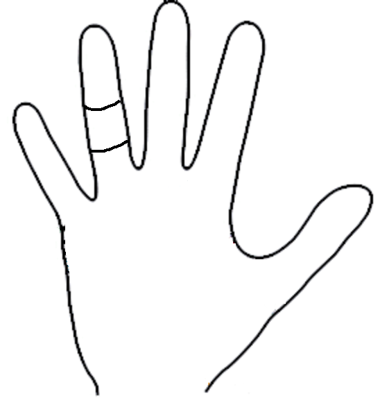 Short little finger